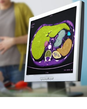 NextGen Office cloud based EMR for Gastroenterology